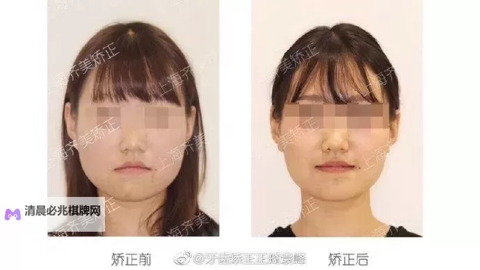 走一下撞一下深深咬合的小说视频：热血剧情全景展现图1