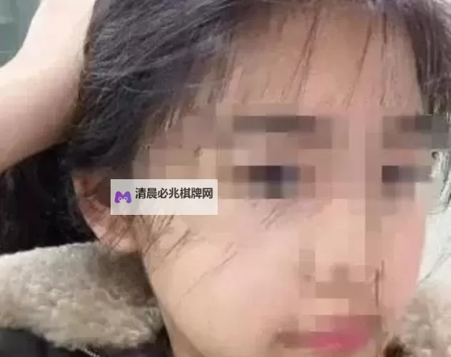 云南14学生真实初次破初视频:青春成长的真实瞬间图1