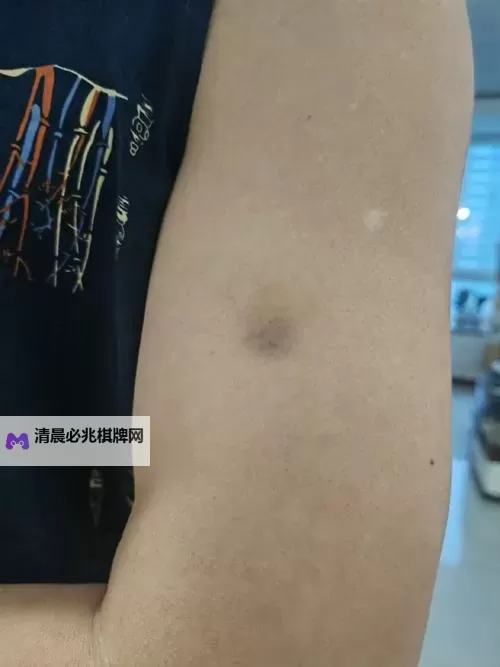 紫黑色肿大横冲直撞:夜晚街头的惊魂一幕图1