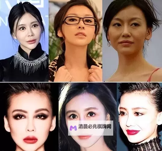 《揭秘整容天后百度影音:她的变美之路与背后故事》图1